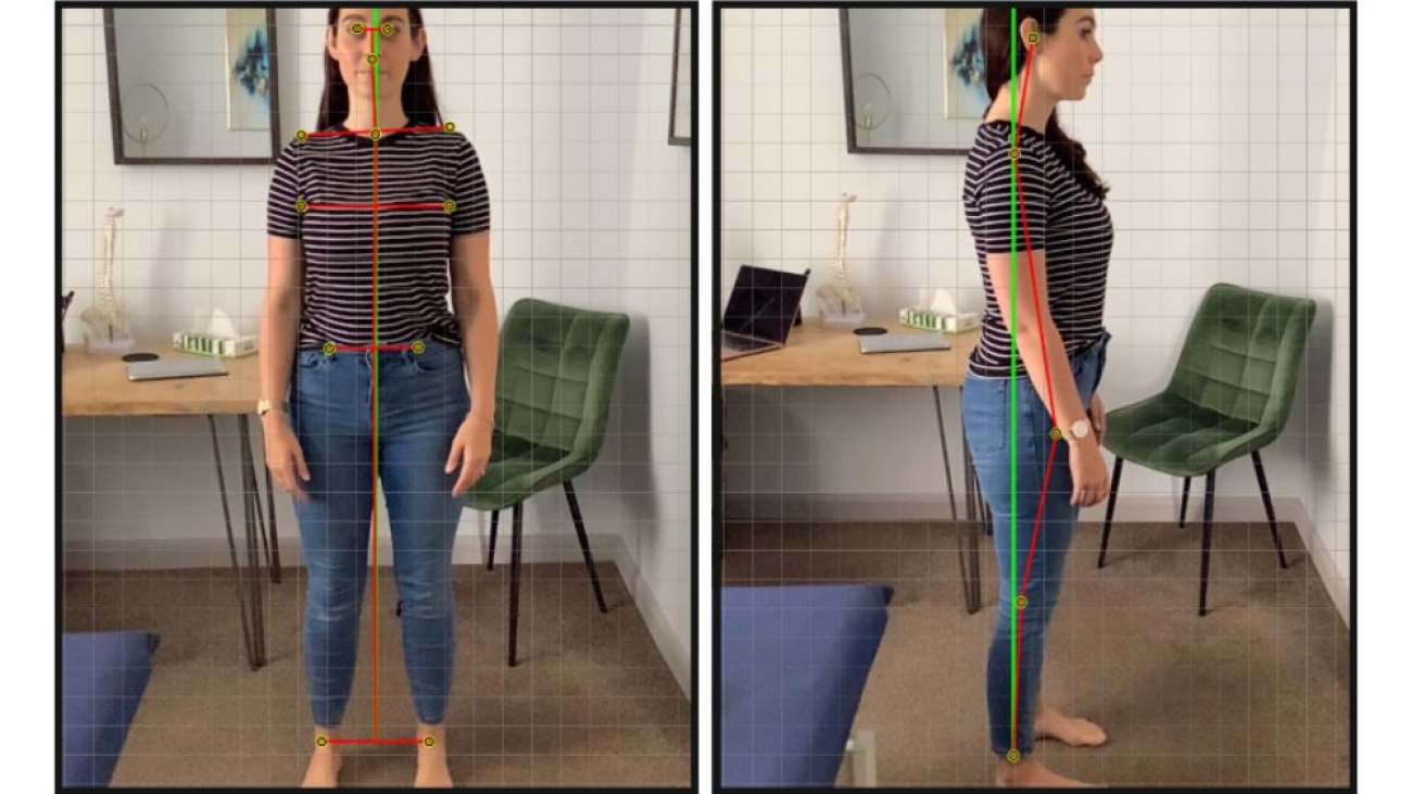 Example of a posture screen result